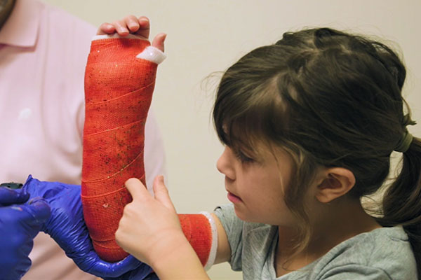 Getting A Cast How casts are made | Parkview Health