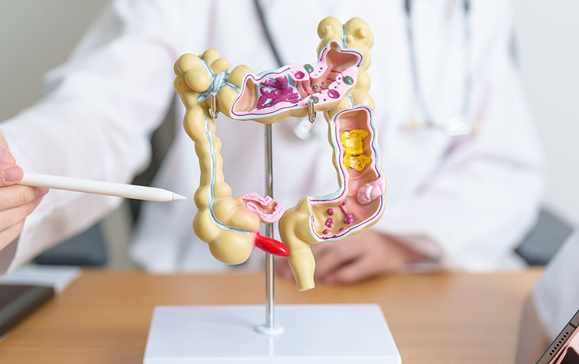 colorectal cancer detection